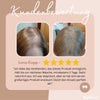 1+1 Free | BlenderEase™ – Hairline Filler & Hairline Correction