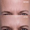 SmoothSilker™ – Silicone anti-Wrinkle Patch
