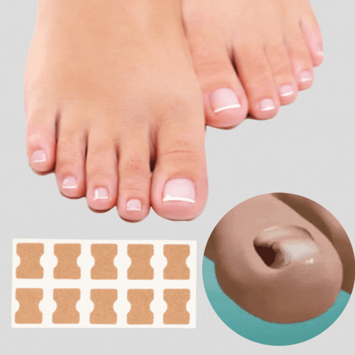 PatchCorrect™ - Correction Patches for Beautiful and Healthy Nails