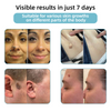 WartLaserPen™ – Laser Mole and Wart Remover