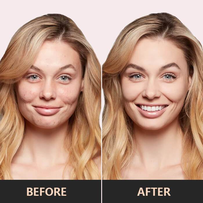 Tricolor™ – 3-in-1 Concealer Palette