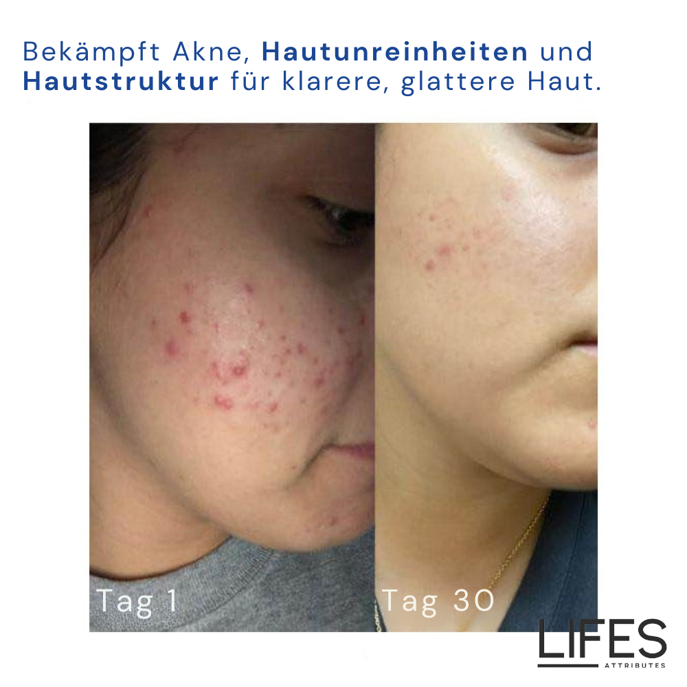 DermaCream™ - Retinol Cream for Radiant Skin