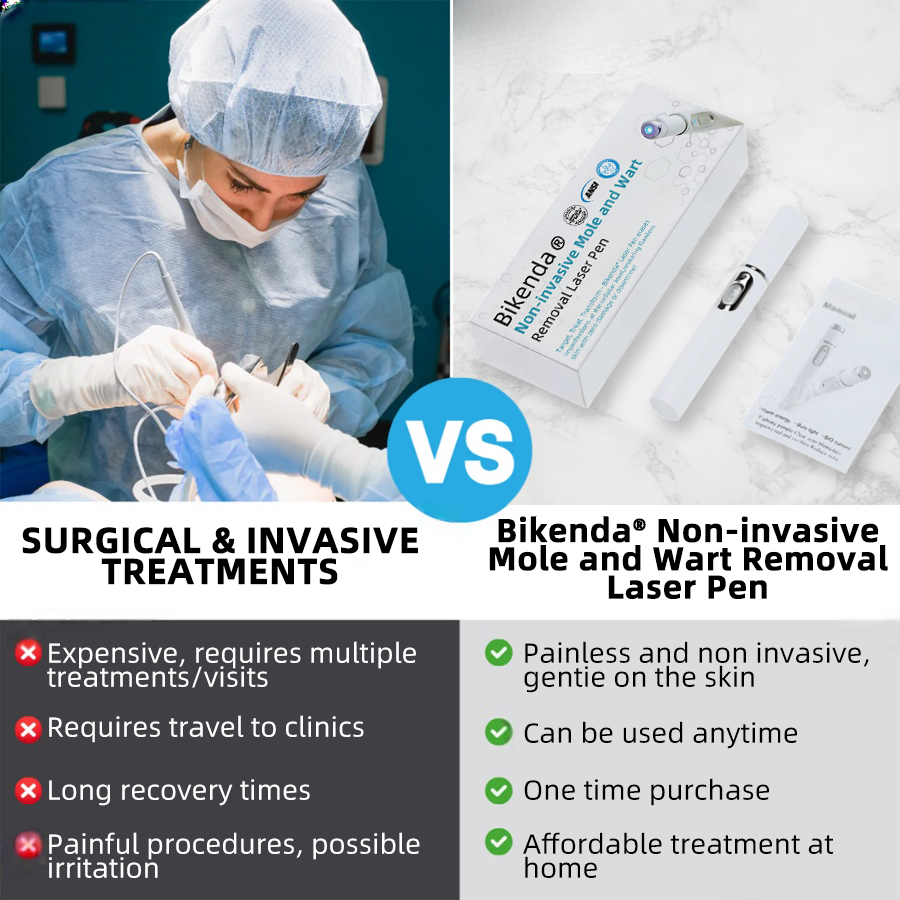 WartLaserPen™ – Laser Mole and Wart Remover