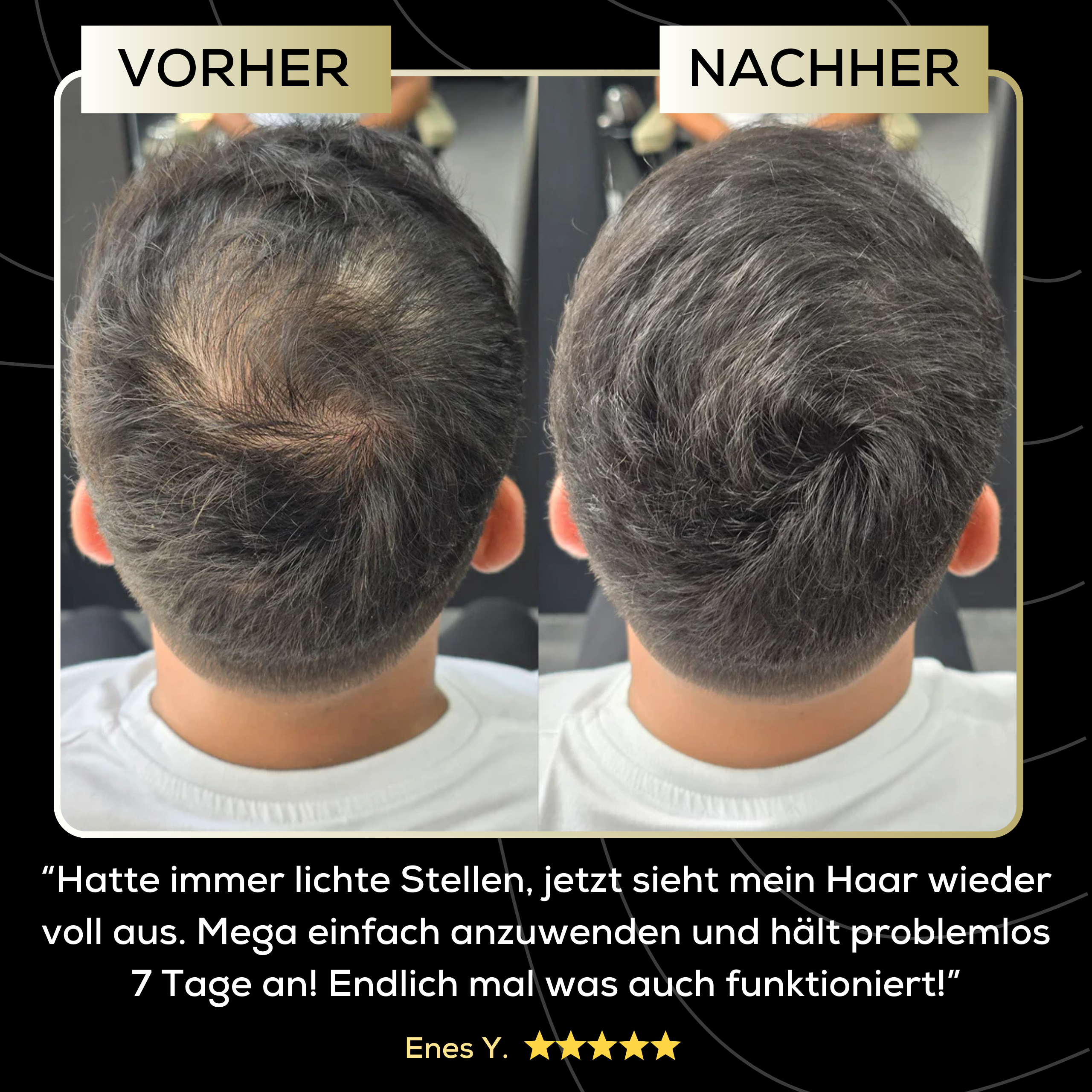 ScalpFiller™ – Invisible Scalp Color for Thicker and Fuller Hair