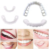 DentureSnap™ – Instant Snap-On Veneers