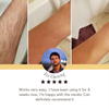 SilkSoft™ – Pain-free Hair Removal