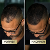 ScalpFiller™ – Invisible Scalp Color for Thicker and Fuller Hair