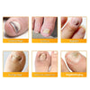 1+1 Free | Nailoxx™ – Discreet Ant-fungal Nail Patches