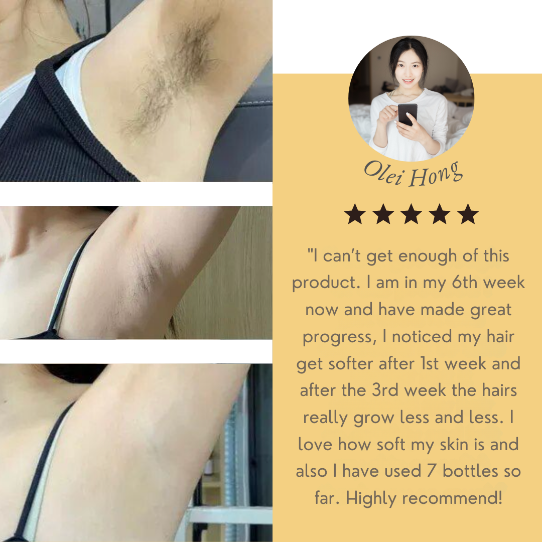 SilkSoft™ – Pain-free Hair Removal