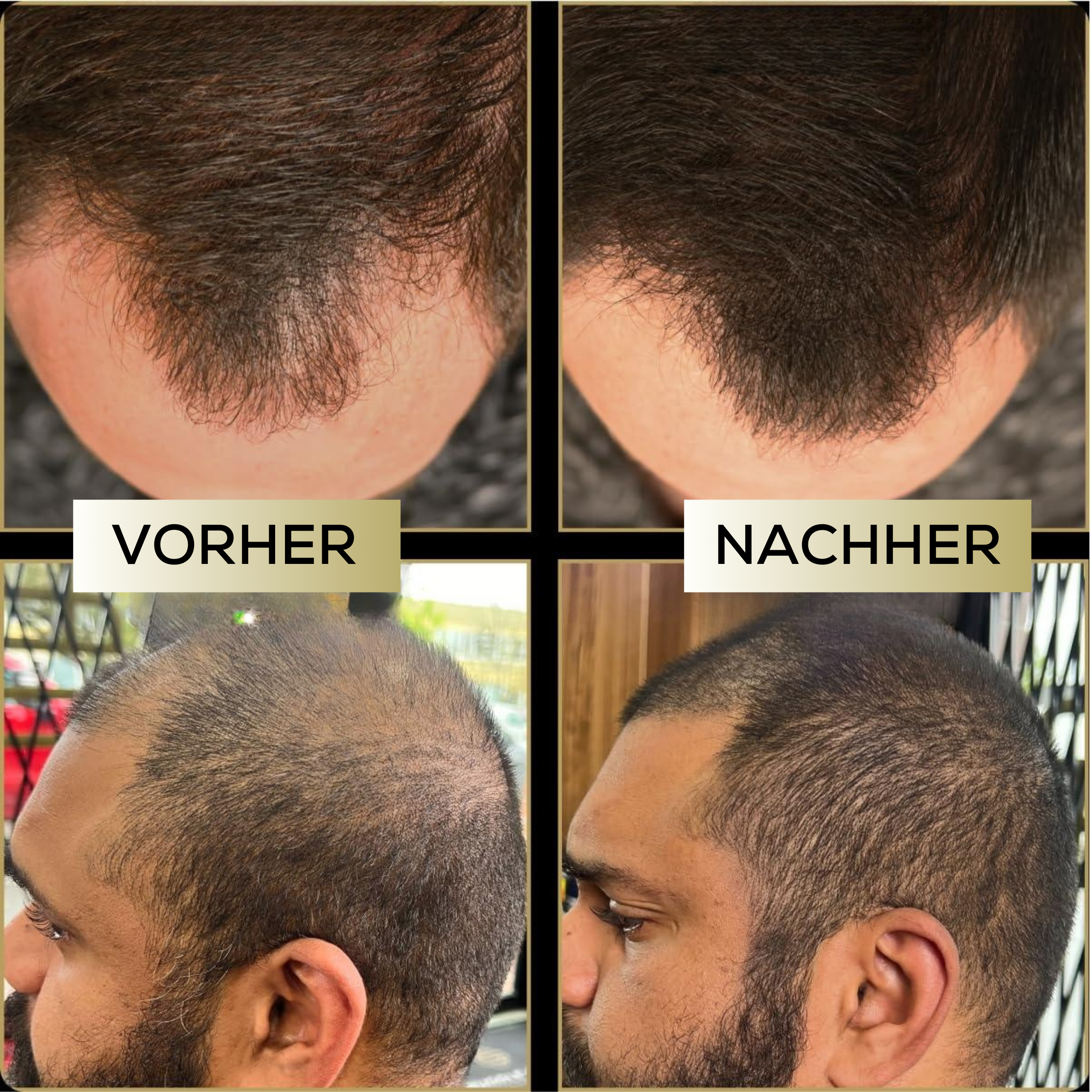 ScalpFiller™ – Invisible Scalp Color for Thicker and Fuller Hair