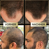 ScalpFiller™ – Invisible Scalp Color for Thicker and Fuller Hair