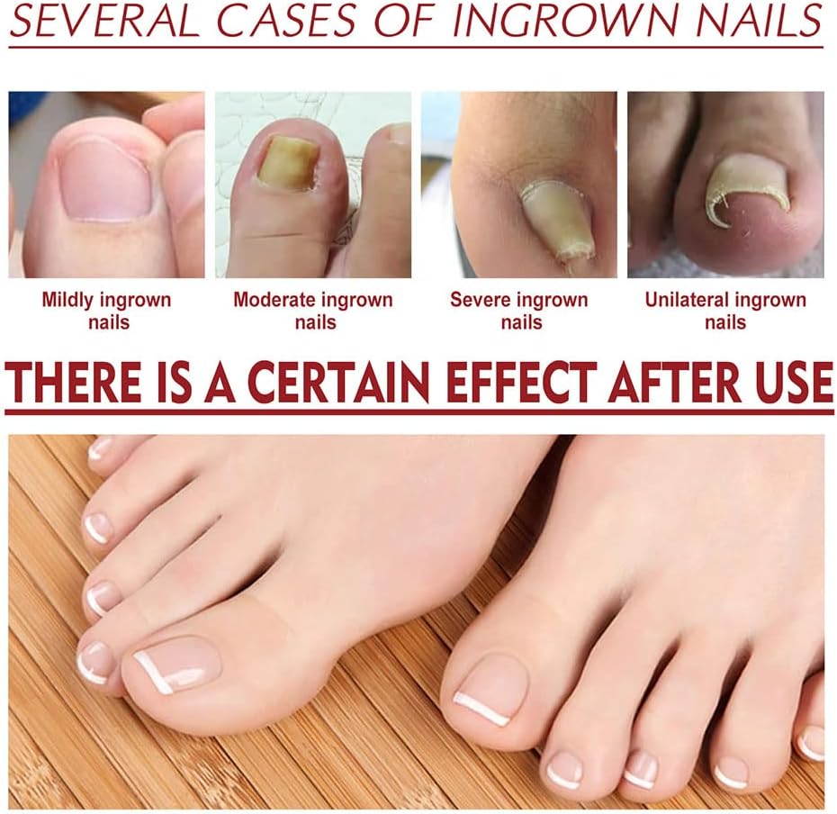 1+1 Free | DropToes™ – Nail Repair Serum