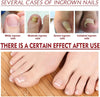 1+1 Free | DropToes™ – Nail Repair Serum