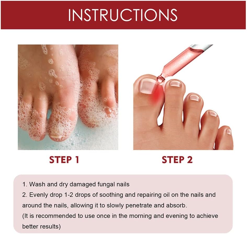 1+1 Free | DropToes™ – Nail Repair Serum