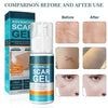 1+1 Free | AdScarGel™ – Gel for Scar Treatment