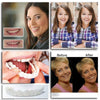 DentureSnap™ – Instant Snap-On Veneers