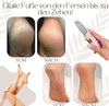 Callusos™ – Electric Callus Remover