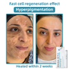 WartLaserPen™ – Laser Mole and Wart Remover
