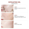 SkinExfoliate™ – Gentle Exfoliating Gel