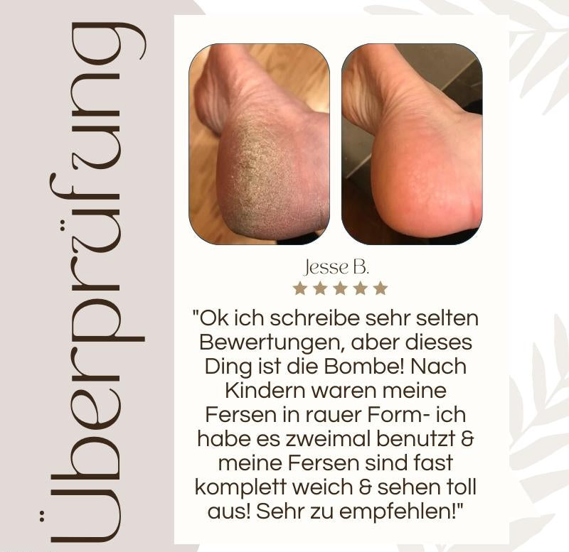 Callusos™ – Electric Callus Remover