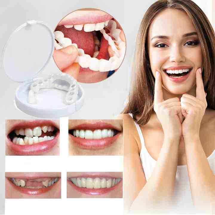 DentureSnap™ – Instant Snap-On Veneers