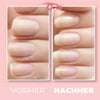 1+1 Free | NailWonder™ - Nail Repair Gel