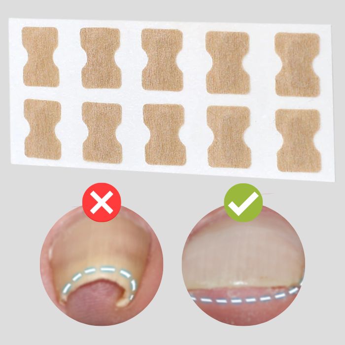 PatchCorrect™ - Correction Patches for Beautiful and Healthy Nails
