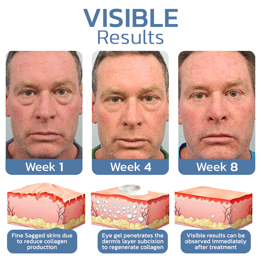 1+1 Free | OpenEyes™ - Rejuvenating Eye Lifting Gel for Men and Women