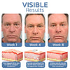 1+1 Free | OpenEyes™ - Rejuvenating Eye Lifting Gel for Men and Women