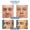 1+1 Free | OpenEyes™ - Rejuvenating Eye Lifting Gel for Men and Women