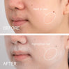 ContourBody™ – Hair detection Spray