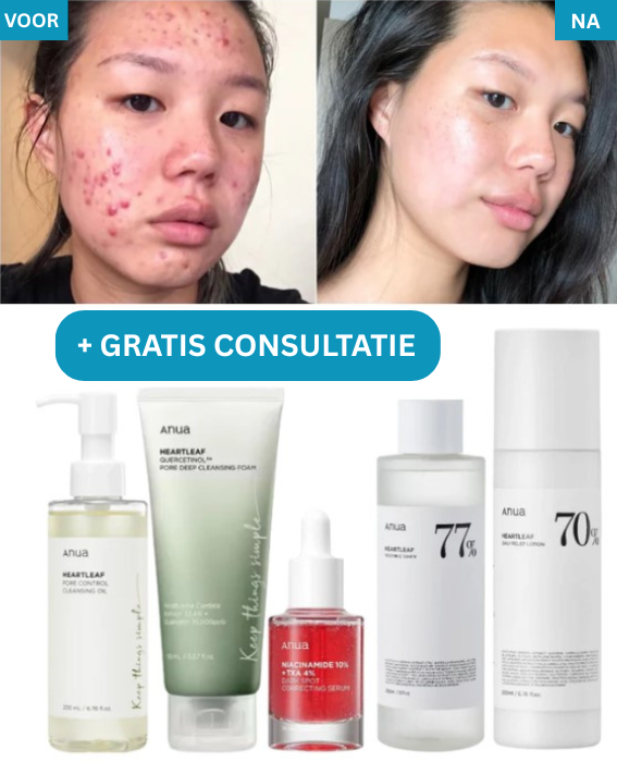 KoreanSet™ – Complete Korean Skincare Set