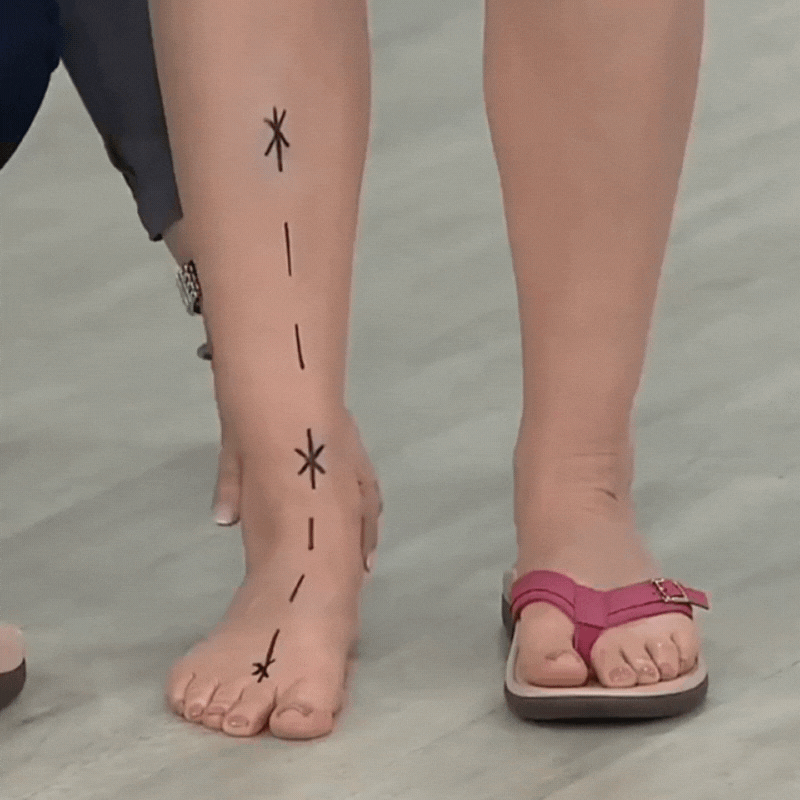 OrthoComfort™ – Orthopedic Sandals