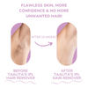 GlowSoftSkin™ – Pain-free IPL Laser Hair Remover