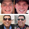 DentureSnap™ – Instant Snap-On Veneers