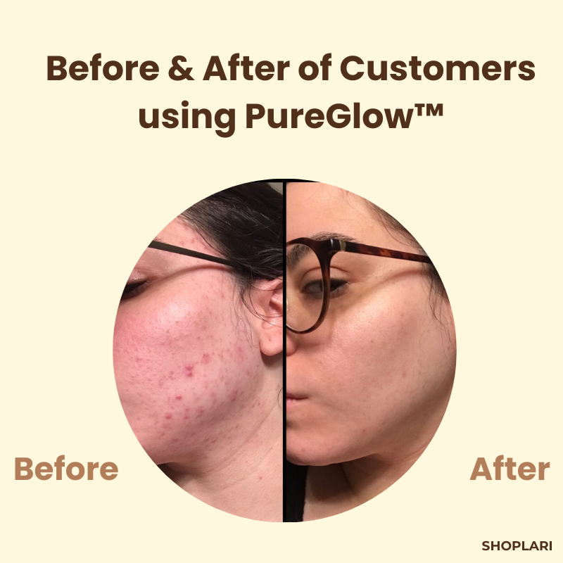 TeaCleansing™ – Black Tea Mask