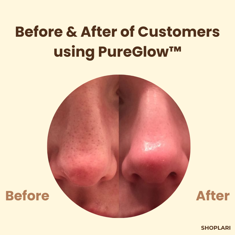 TeaCleansing™ – Black Tea Mask
