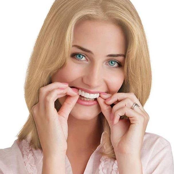 DentureSnap™ – Instant Snap-On Veneers