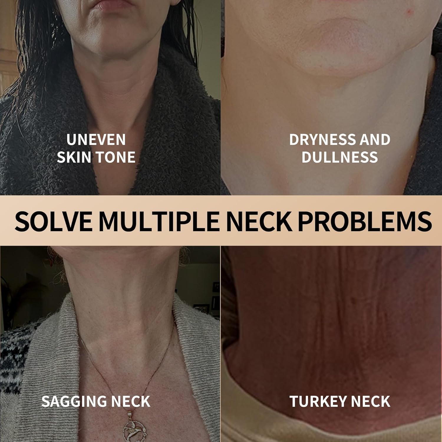 1+1 Free | NeckLift™ – Firming Cream