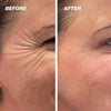 1+1 Free | GlowScar™ – Silicone Scar Removal Sheets