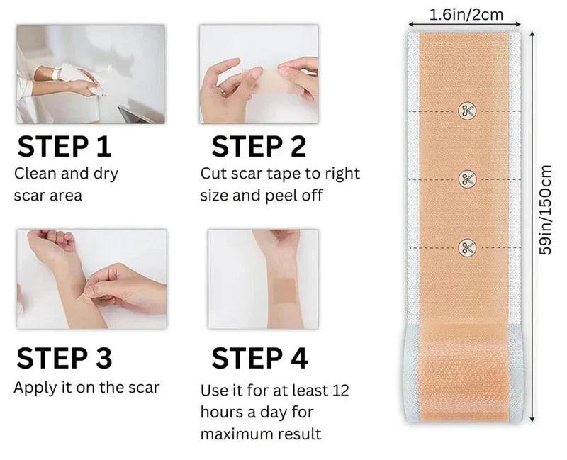1+1 Free | GlowScar™ – Silicone Scar Removal Sheets
