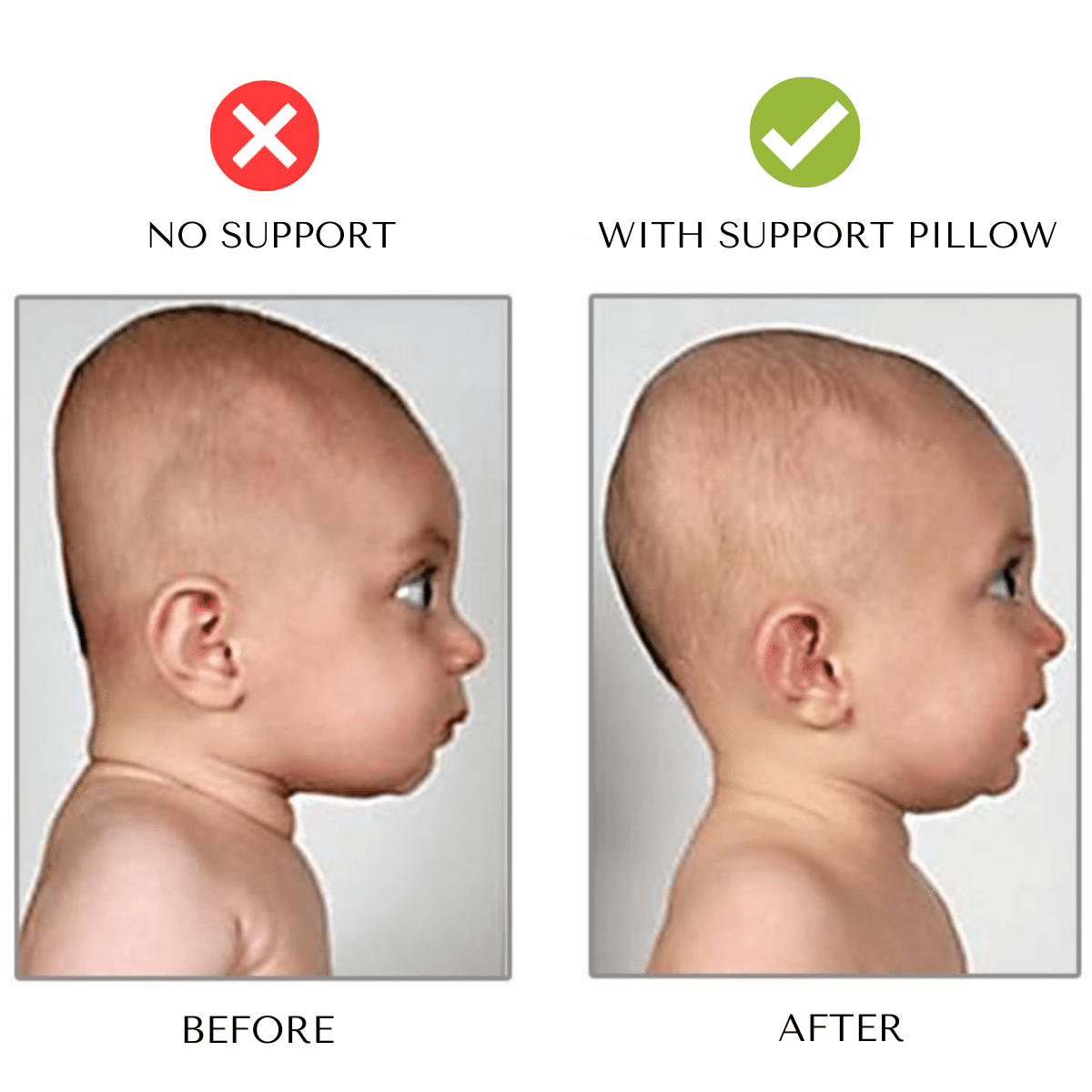 1+1 Free | PillowNeck™ – Orthopedic Baby Pillow