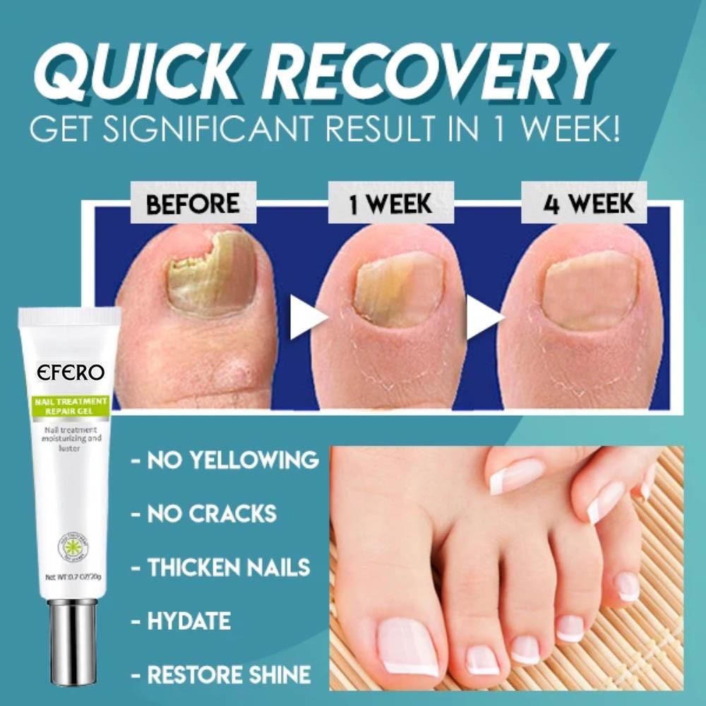 1+1 Free | Naily™ – Fast and Effective Results