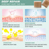 1+1 Free | GlowScar™ – Silicone Scar Removal Sheets