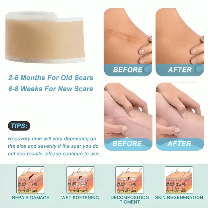 1+1 Free | GlowScar™ – Silicone Scar Removal Sheets