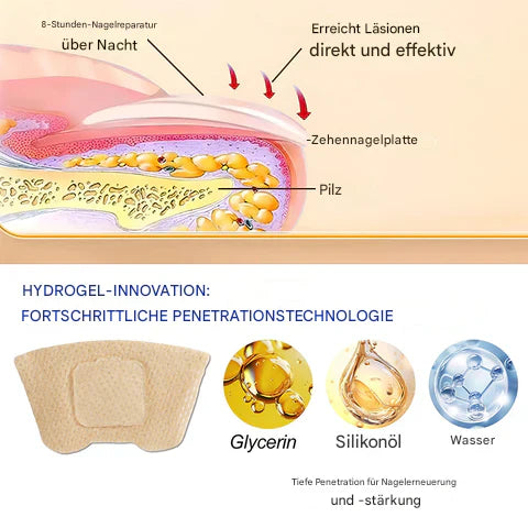 1+1 Free | Nailoxx™ – Discreet Ant-fungal Nail Patches