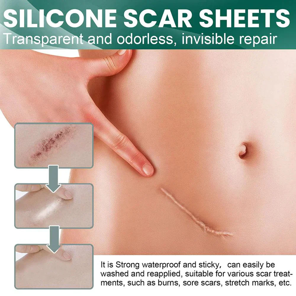 1+1 Free | GlowScar™ – Silicone Scar Removal Sheets